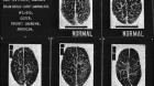 How Racism Can Lead To The Abuse Of Law & Science (Part 3) How Racism Can Lead To The Abuse Of Law & Science (Part 3)