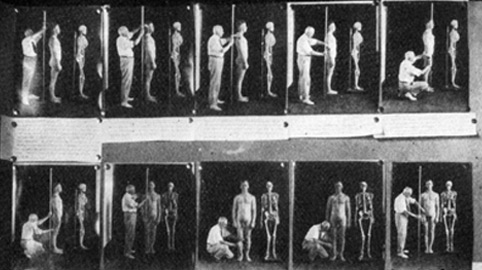 A eugenics physical (Source: understandingrace.org)