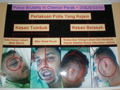 This is Malaysian Police brutality. Images from http://malaysiaindianabused.blogspot.com/